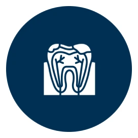 Dental root structure illustration